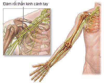 Phong bế thần kinh có thể được sử dụng ở các vùng cơ thể khác nhau