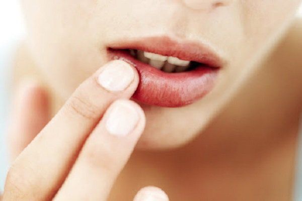 Minh họa thiếu vi chất dinh dưỡng liên quan đến co giật cơ