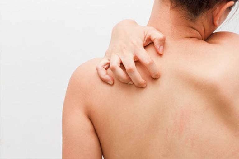 What nutrients are deficient when the body experiences itching? | Vinmec