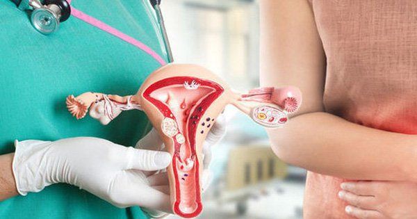 CÁC LOẠI THUỐC ĐẶC TRỊ LẠC NỘI MẠC TỬ CUNG PHỔ BIẾN HIỆN NAY