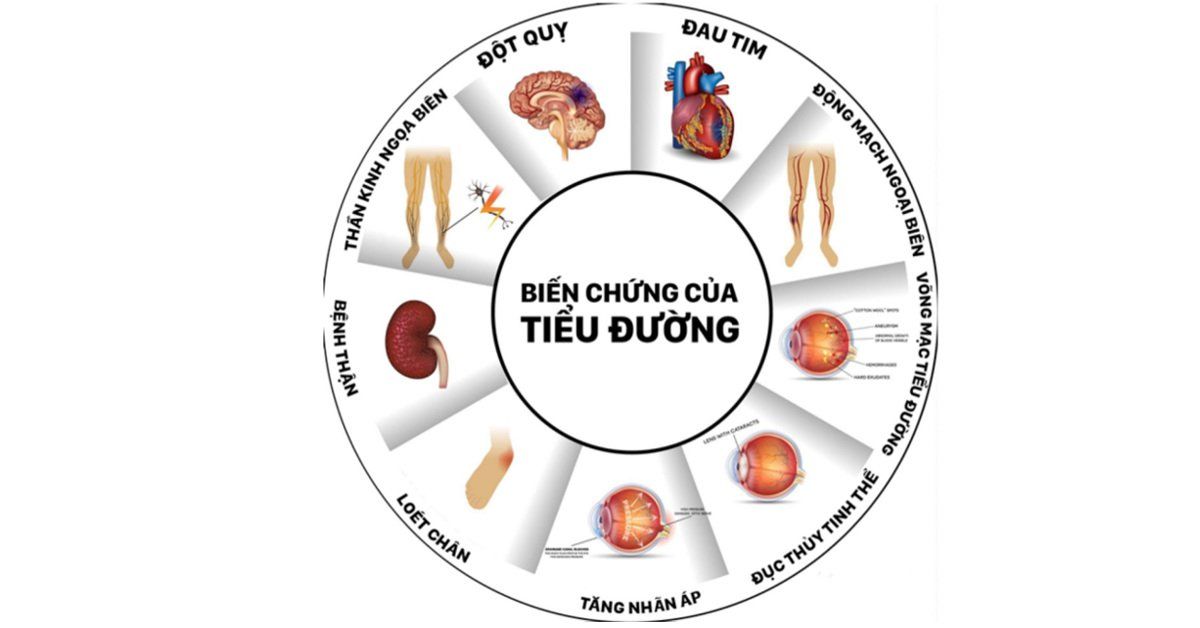 Các biến chứng tiểu đường thường gặp | Vinmec