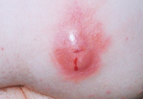 Sochli jinsiy aloqa filmlar Homiladorlikning 28-haftasida jinsiy aloqa