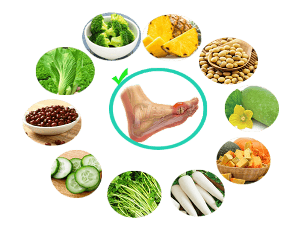 Tham khảo bữa sáng cho người bệnh Gout | Vinmec