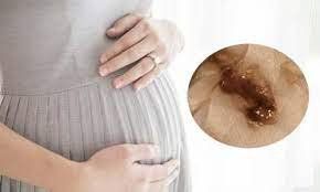 Ra máu nâu đen kèm đau nhói bụng khi mang thai 5 tuần có sao không?