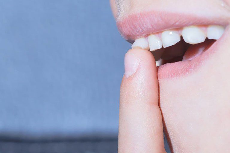 Răng lung lay làm sao để chắc lại? | Vinmec