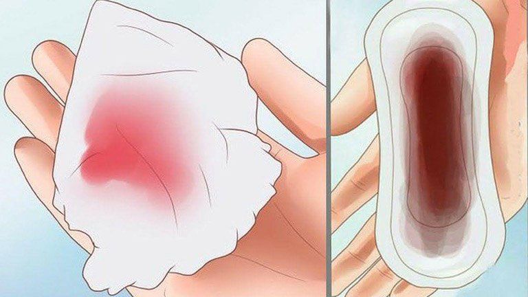 BIỂU HIỆN SAU KHI ĐẶT THUỐC PHỤ KHOA POLYGYNAX BAO GỒM CẢM GIÁC DỄ CHỊU VÀ GIẢM NGỨA RÕ RỆT