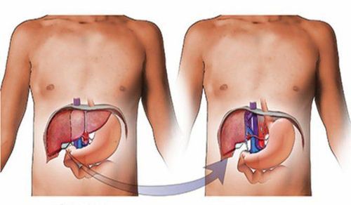 Những điều cần biết về hiến mô, tạng: ý nghĩa nhân văn và quy trình đăng ký tại Việt Nam 