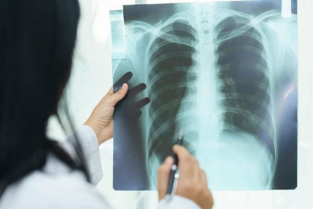 Based on the results of chest X-rays, doctors can see dangerous diseases originating from the lungs