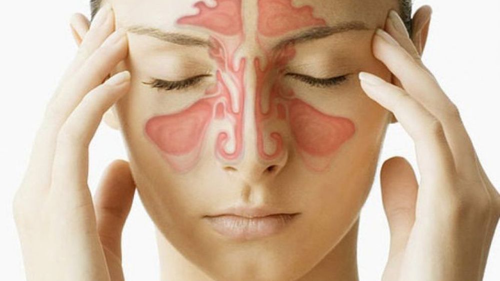 Bệnh xoang là lý do khiến bạn chóng mặt khi ngủ dậy