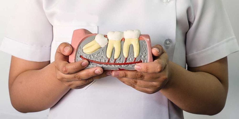 Răng khôn là răng mọc cuối cùng và nằm sâu ở trong hàm răng