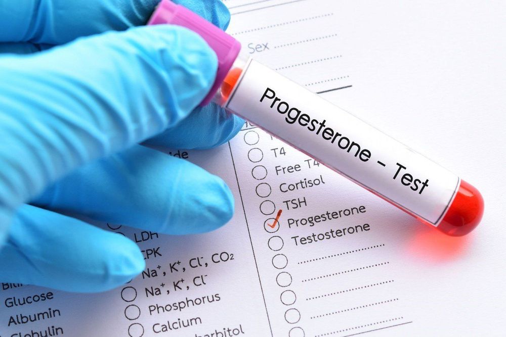Xét nghiệm progesterone theo dõi thai kỳ có nguy cơ cao