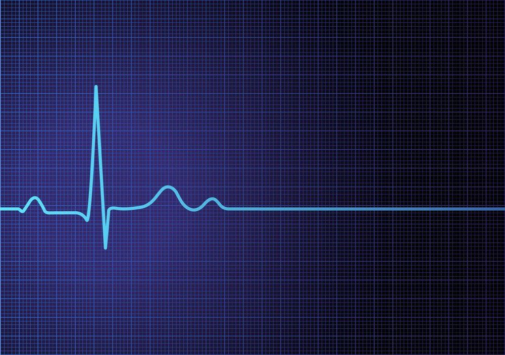 Improper dosage of local anesthetics can cause cardiac arrest

