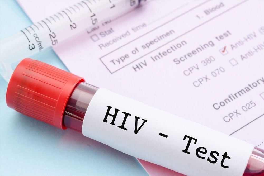 
Các cặp vợ chồng cần xét nghiệm HIV trước khi làm IVF
