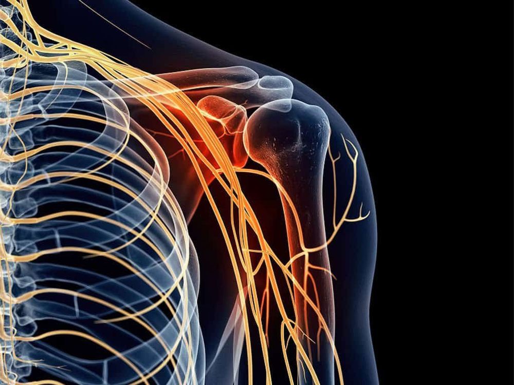 
Đám rối thần kinh cánh tay là một bộ phận khá phức tạp nên công việc gây tê các dây thần kinh này thường rất khó khăn

