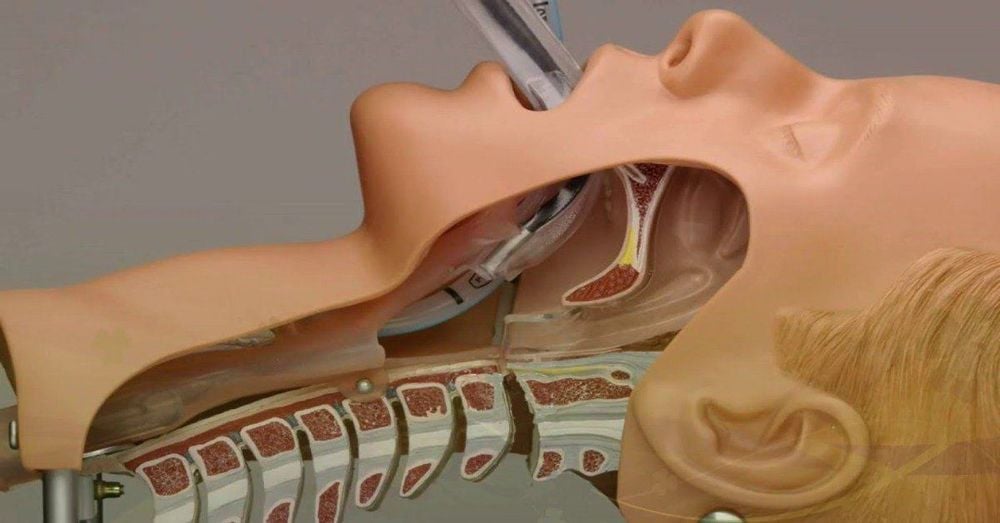 Chấn thương khí quản có thể gây nguy hiểm đến tính mạng người bệnh