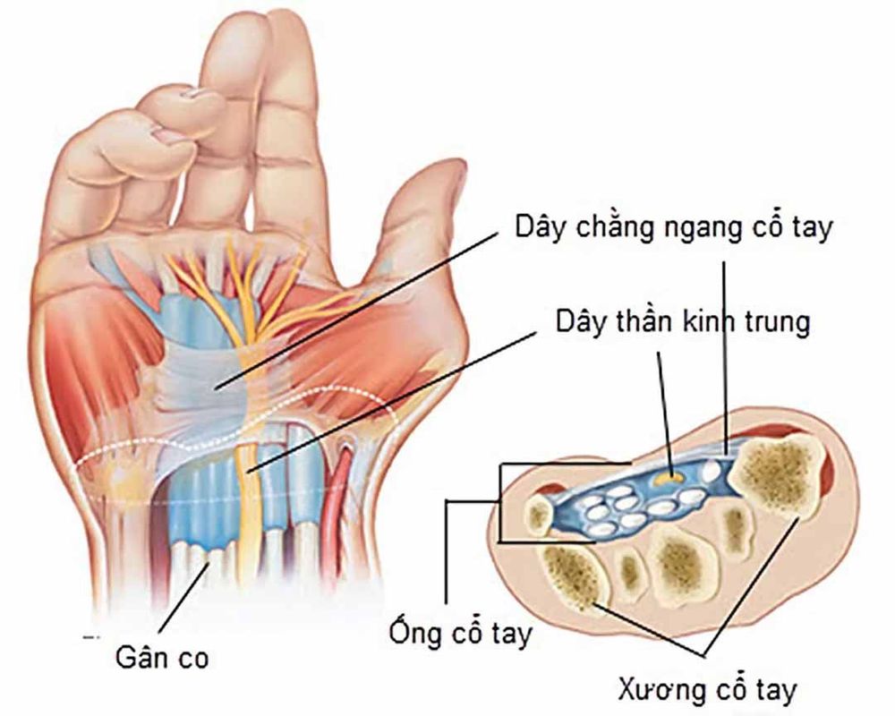 
Hình ảnh dây chằng ngang cổ tay
