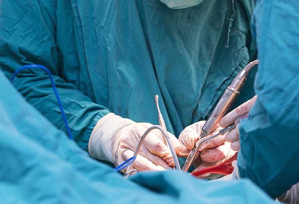 U màng tủy có thể được điều trị bằng phẫu thuật cắt bỏ toàn phần