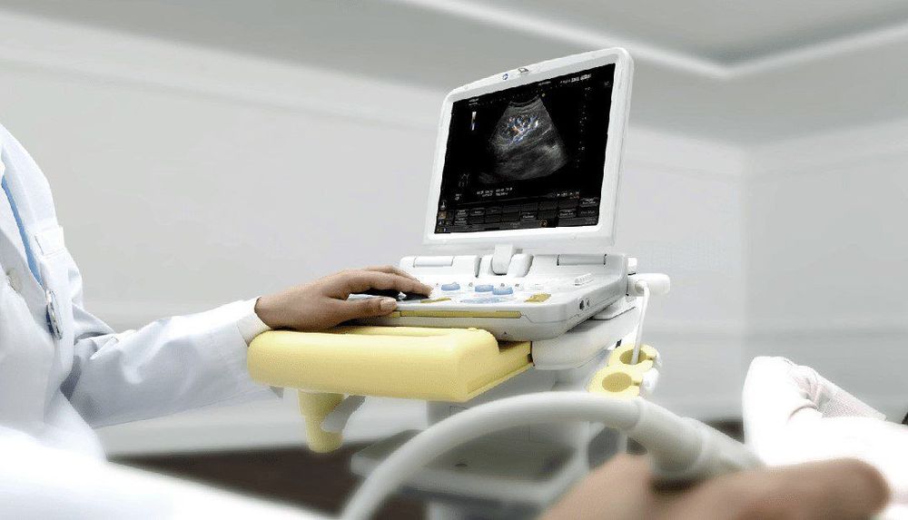 Nguyên lý hoạt động cơ bản của máy siêu âm