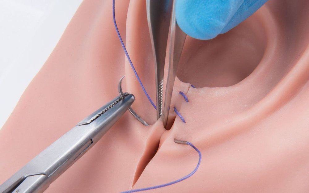 After the episiotomy, the doctor will prescribe you some pain relief medications