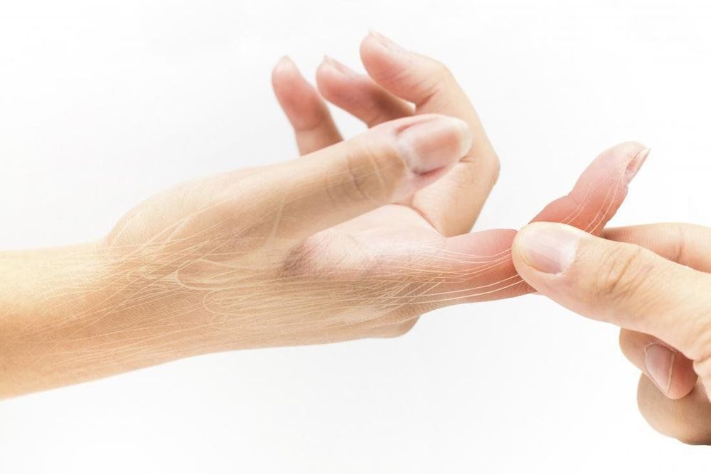 Finger sprains can lead to swelling in the affected finger.