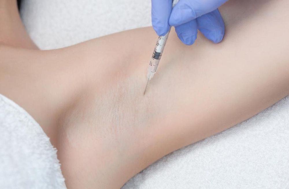 Botox is used to treat smelly armpits.