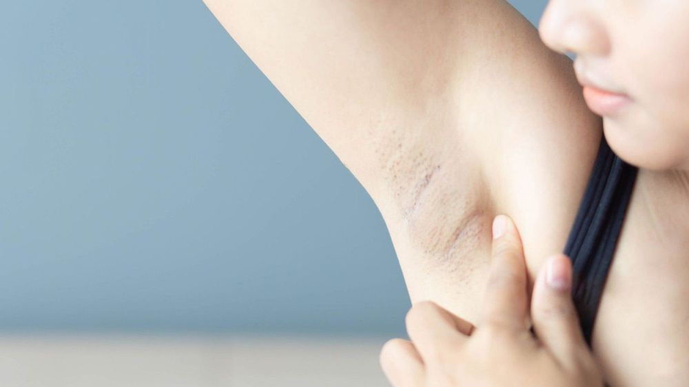 It is advisable to choose deodorants for pregnant women that are made from natural ingredients