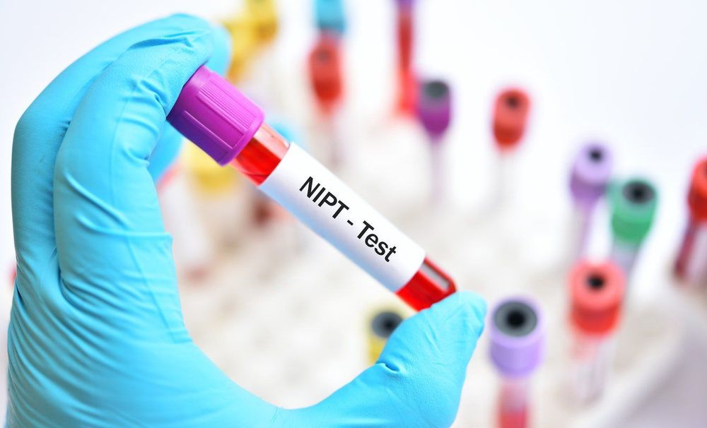 NIPT is a non-invasive screening test.