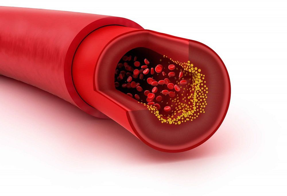 Giải đáp tỷ lệ cholesterol là gì?