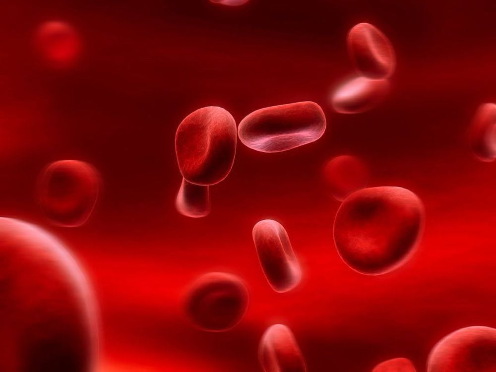 Weak small red blood cell anemia can have many of the same characteristics as iron deficiency anemia.