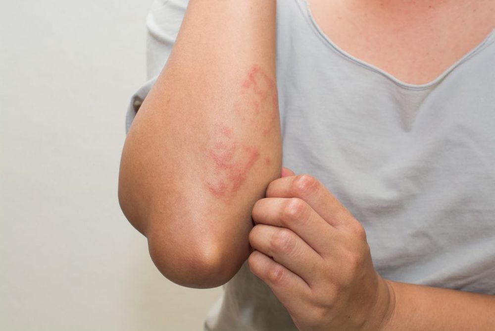 Rash as a possible adverse reaction when using Glotadol