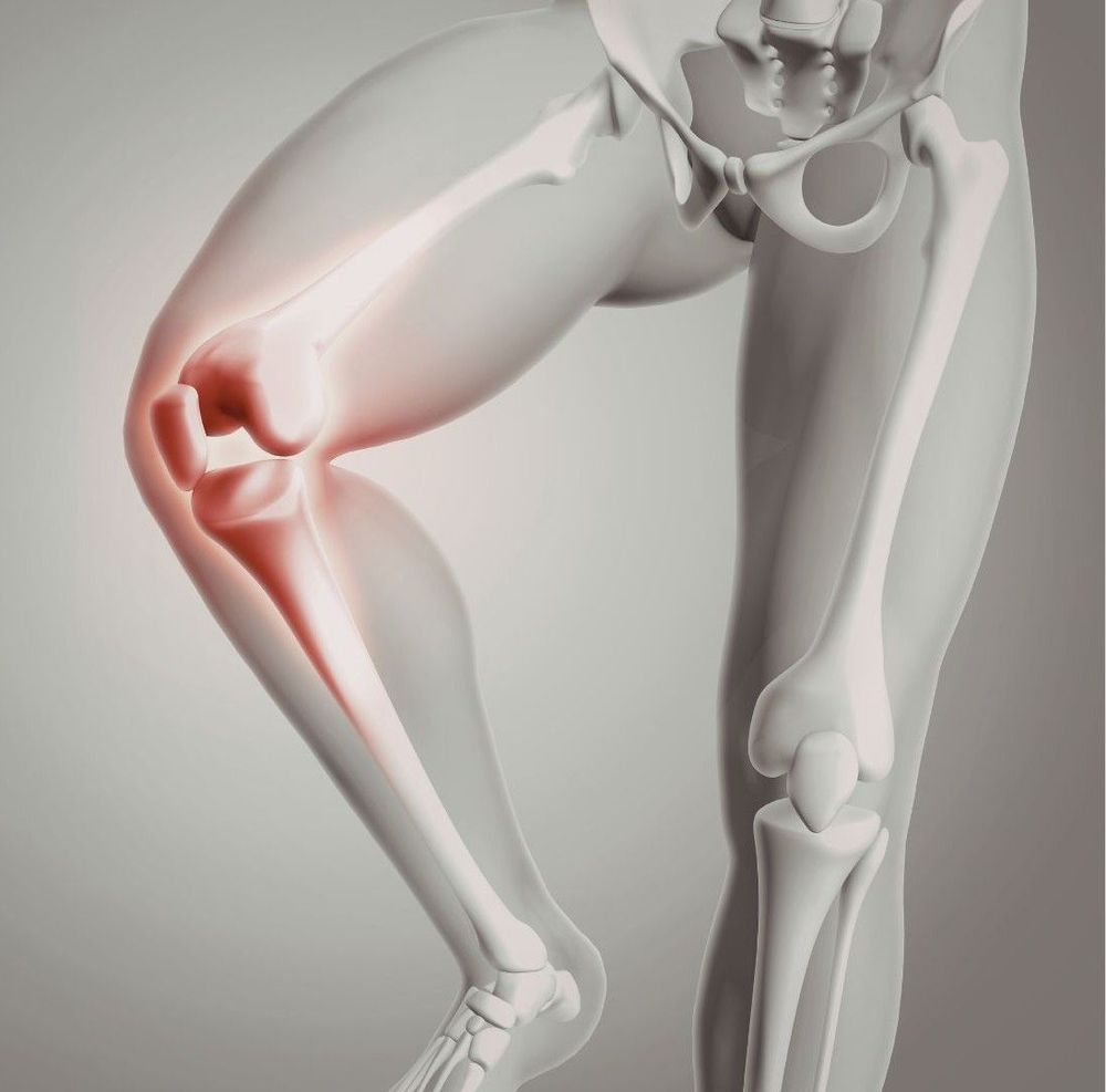 Joint effusion on ultrasound