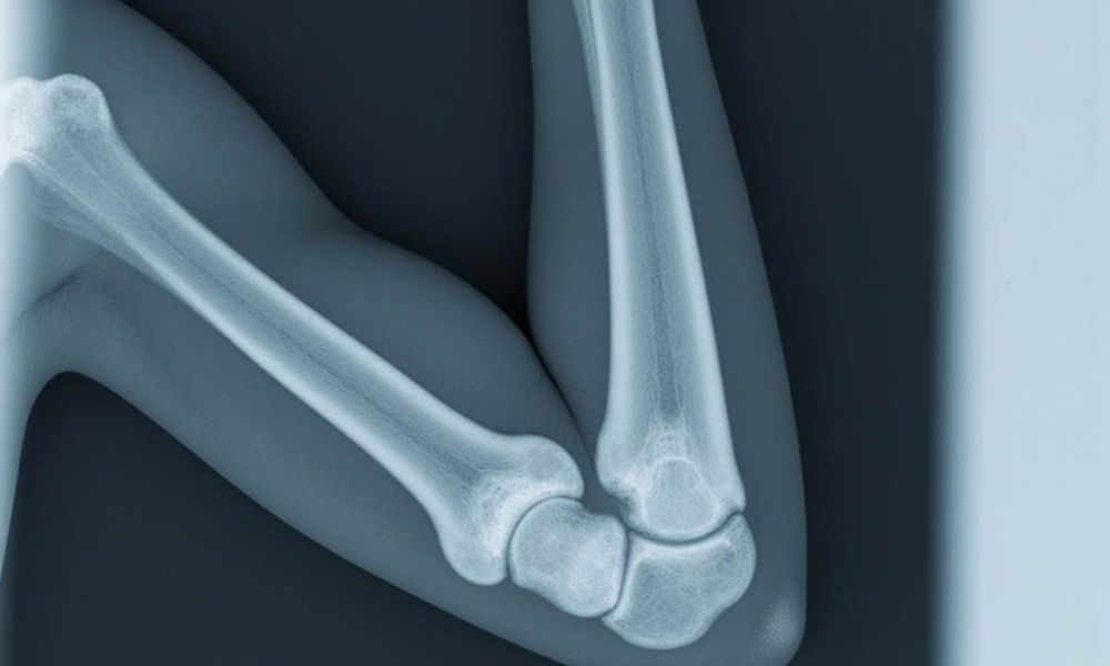 Vinmec đầu tư các công nghệ hiện đại, bao gồm CT scan, nhằm xác định rõ các tổn thương ở khớp.