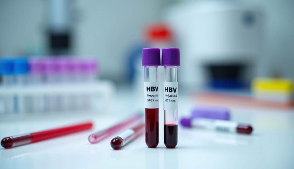 Xét nghiệm HBeAg là một trong các xét nghiệm cần được tiến hành khi có kết quả HBsAg+, nhằm đánh giá mức độ sao chép và hoạt động của virus viêm gan B (HBV).