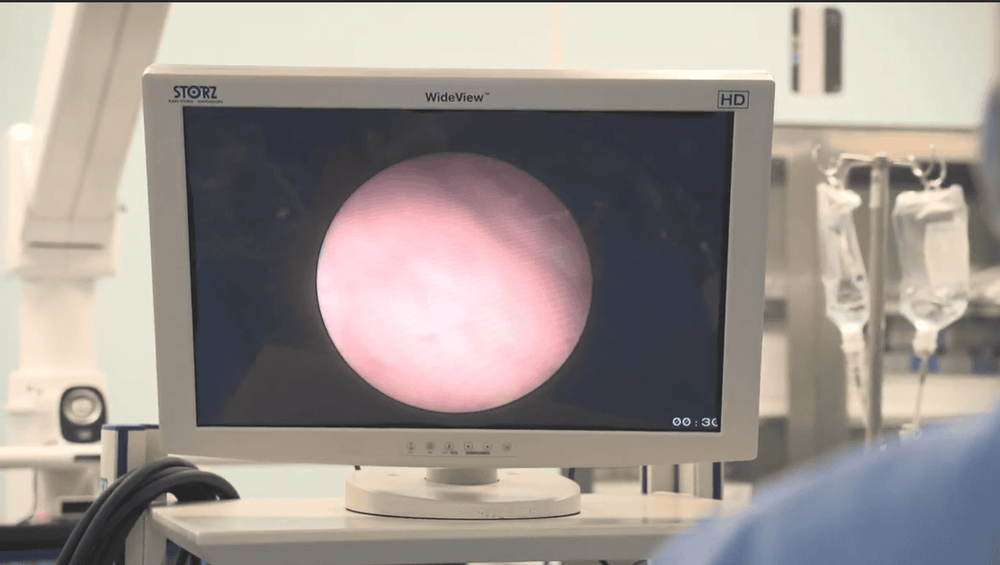 Chẩn đoán bệnh Crohn và viêm loét đại tràng đều bằng cách nội soi đại tràng.