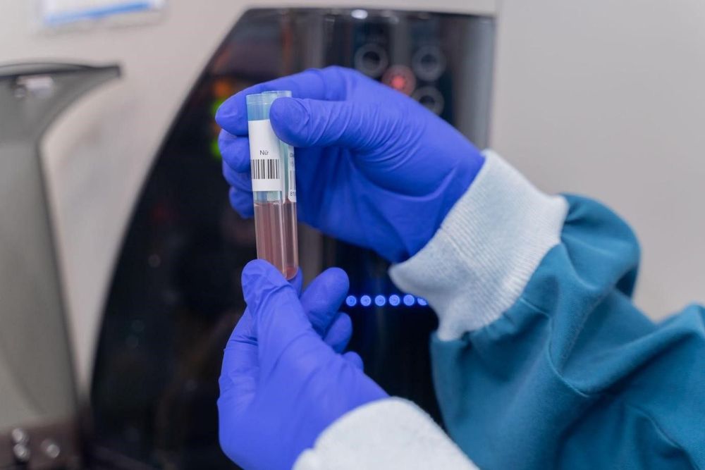 Điều trị thalassemia bằng tế bào gốc cuống rốn là một lựa chọn an toàn và hiệu quả, giúp bệnh nhân thoát khỏi việc truyền máu định kỳ