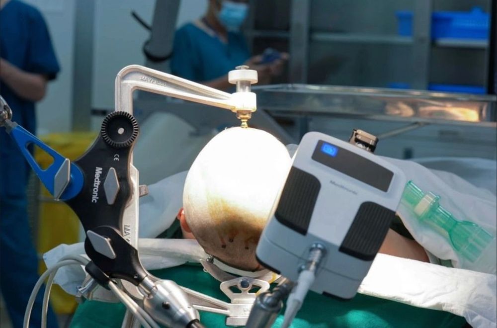 Vinmec Central Park tiên phong sử dụng Robot AutoGuide đặt điện cực đo điện não đồ nội sọ