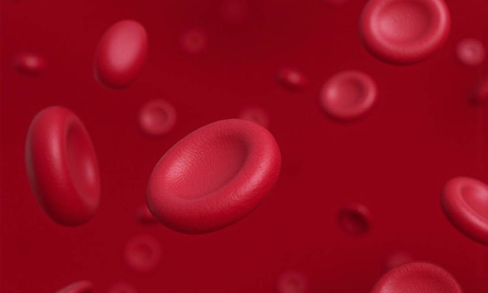Tình trạng thiếu máu là một trong những biến chứng của bệnh Lupus ban đỏ.