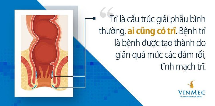 Trĩ vốn là một phần cấu trúc giải phẫu của cơ thể con người.
