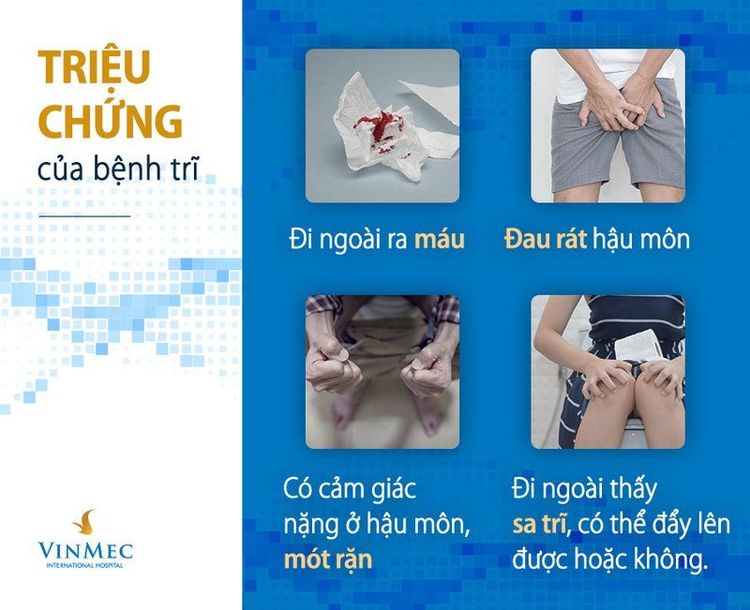 Một số triệu chứng bệnh trĩ điển hình là đi ngoài ra máu và đau rát hậu môn.