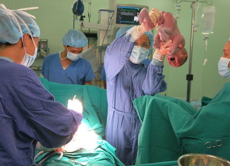 Bí quyết để vết mổ sau sinh nhanh lành, không sẹo