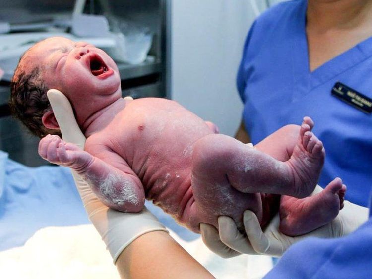 Bộ phận sinh dục của bé bị sưng khi mới sinh là hiện tượng không đáng lo ngại