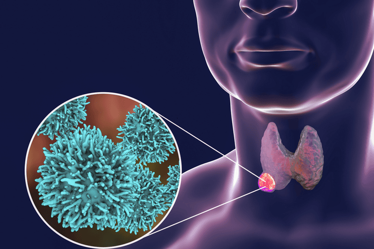 Hormone tuyến giáp ảnh hưởng đến tim mạch gây tăng nhịp tim ở người bệnh