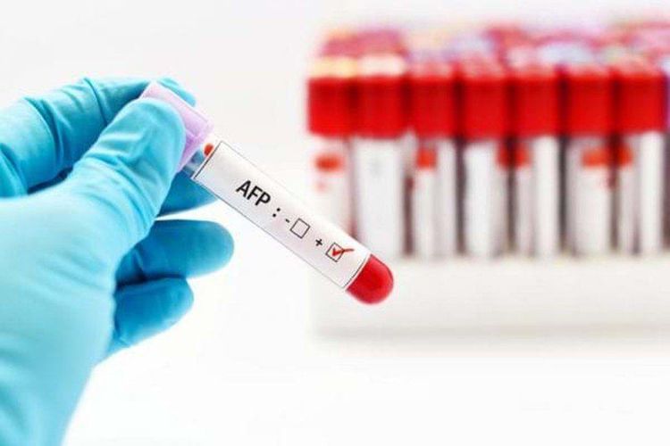 Xét nghiệm AFP và siêu âm gan là phượng tiện giúp sàng lọc ung thư gan