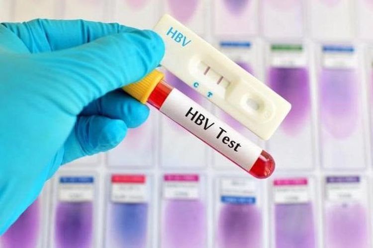 HBsAg test