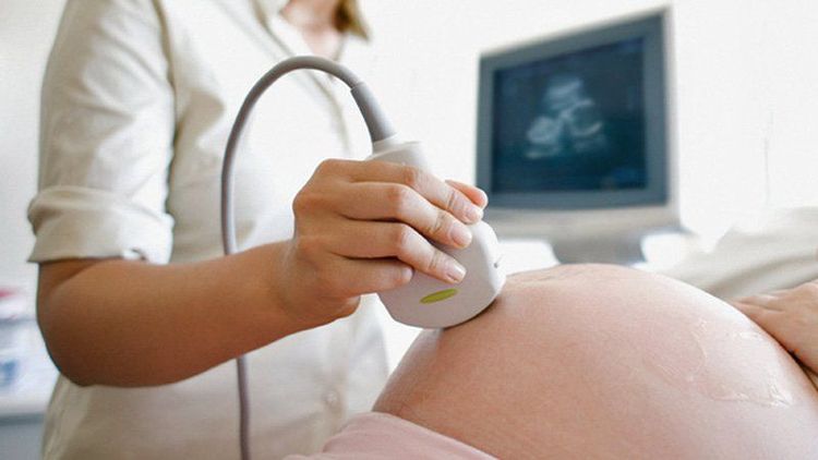 Pregnant women should undergo regular prenatal check-ups throughout the pregnancy.