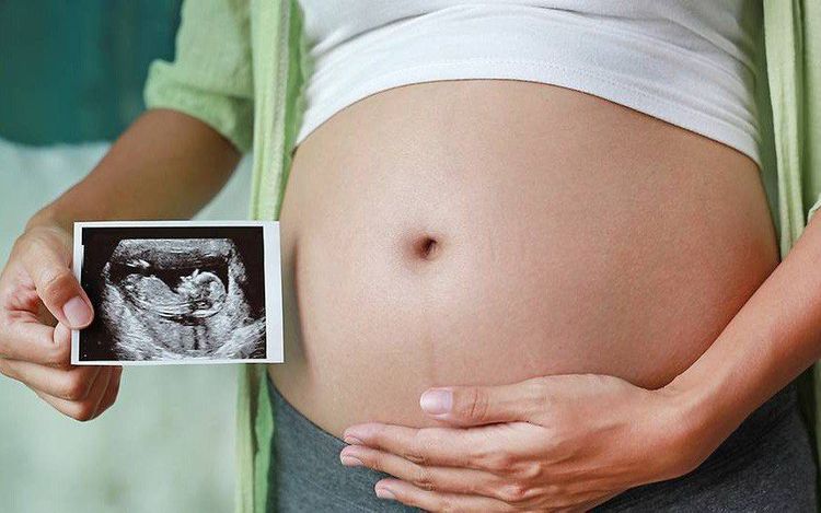 Image of the fetus at 35 weeks