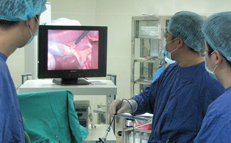 Laparoscopic surgery for colorectal cancer 