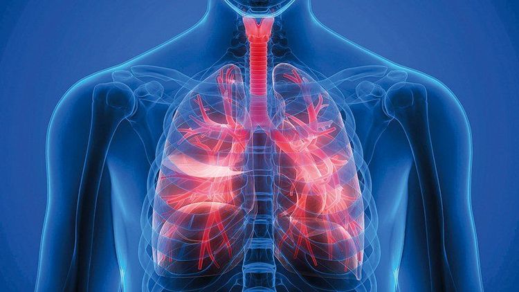 Bệnh phổi tắc nghẽn mãn tính thường đi kèm nhiều bệnh lý nguy hiểm