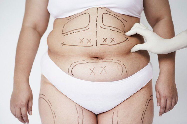 Khi bạn giảm cân, các tế bào mỡ vẫn còn tồn tại và có thể phát triển trở lại