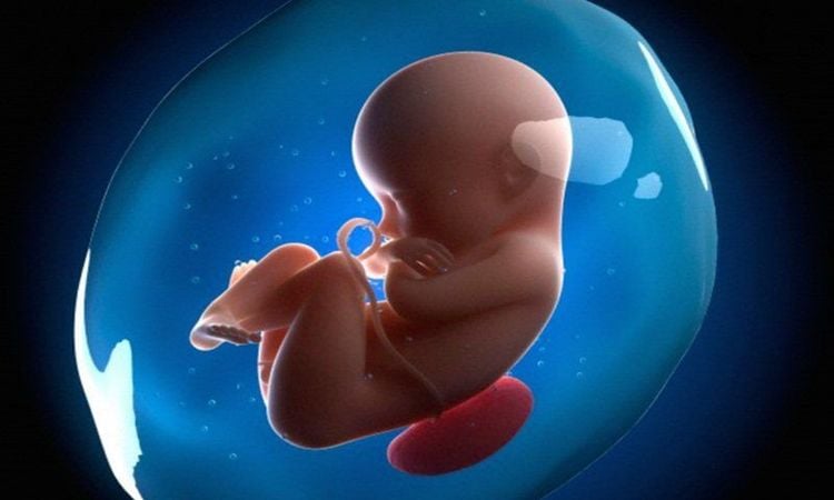 The cause of polyhydramnios (excessive amniotic fluid) has been identified in 10% of pregnant women with gestational diabetes